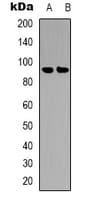 Polyclonal Rabbit anti-Human BRAF / B-Raf Antibody (phospho-Ser446, IHC, WB)