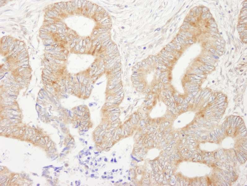 Polyclonal Rabbit anti-Human AKAP1 / AKAP Antibody (aa450-500, IHC, WB)
