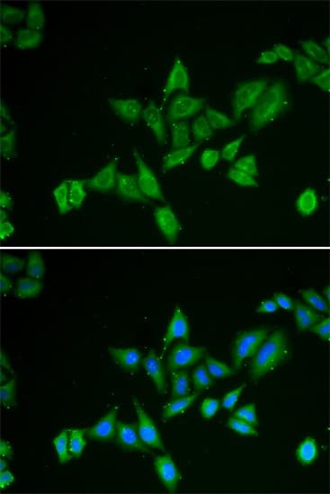Polyclonal Rabbit anti-Human BNIP2 Antibody (IHC, IF, WB)