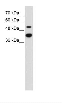 MMP1 Antibody (C-Terminus)