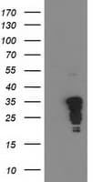 Monoclonal Mouse anti-Human JUN / c-Jun Antibody (clone OTI3G2, IF, WB)