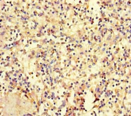 HOXD9 Antibody