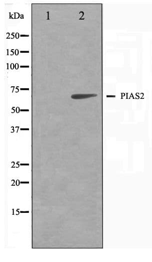 Polyclonal Rabbit anti-Human PIAS2 / PIASX Antibody (WB)