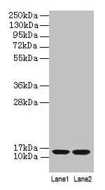B2M / Beta 2 Microglobulin Antibody