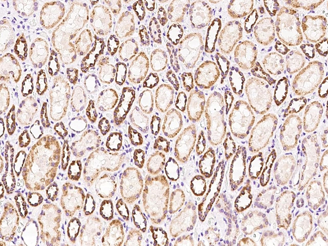 SARS2 / SYS Antibody
