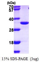 Human IMPA2 Protein (Recombinant His)