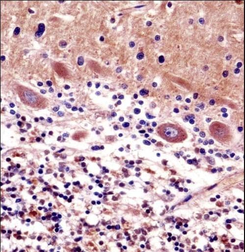 Polyclonal Rabbit anti-Human Yo / CDR2 Antibody (aa420-448, IHC, WB)