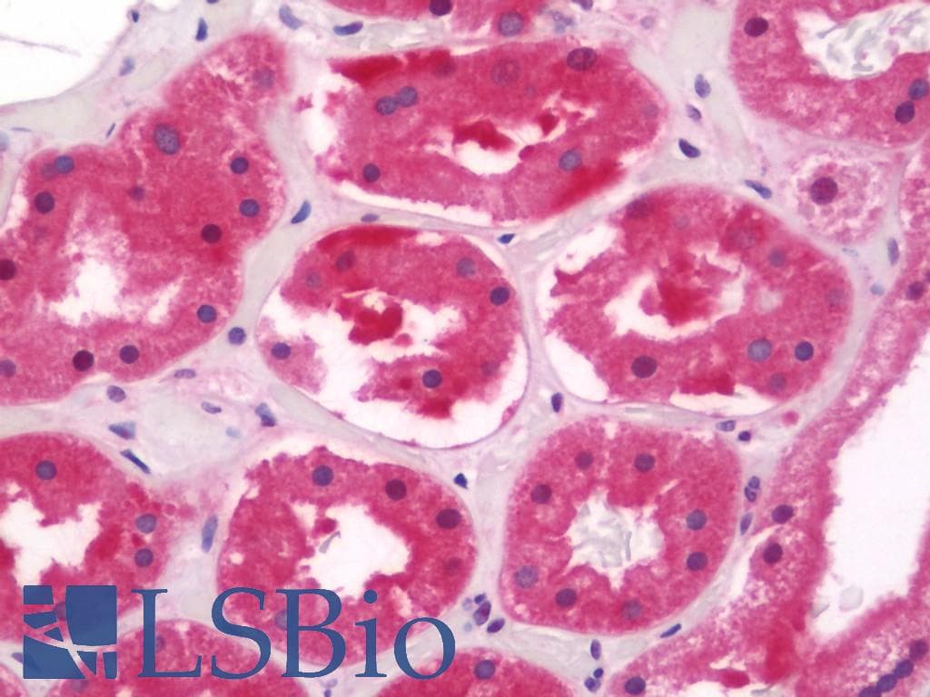 IHC-plus™ Polyclonal Rabbit anti-Human PSMD11 Antibody (aa271-320, IHC, WB)