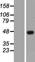 Human SSDP1 / SSBP3 Protein (Over-Expression Lysate Myc-DDK (Flag))
