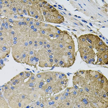 THBS2 / Thrombospondin 2 Antibody