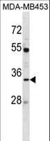 IHC-plus™ AQP3 / Aquaporin 3 Antibody (aa163-191)