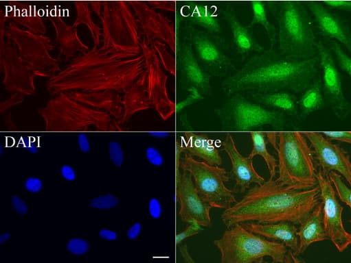 CA12 / Carbonic Anhydrase XII Antibody (clone UMAB121)