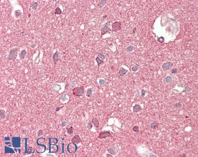 IHC-plus™ Polyclonal Rabbit anti-Human RTN3 / Reticulon 3 Antibody (aa750-800, IHC, WB)
