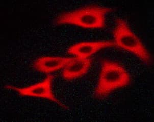 c-Kit / CD117 Antibody (phospho-Tyr703)