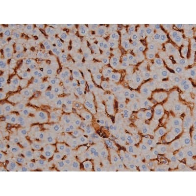MAPT / Tau Antibody (phospho-Ser356)