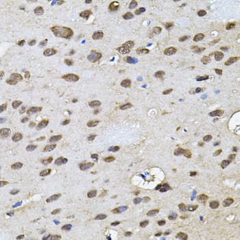 RNF166 Antibody