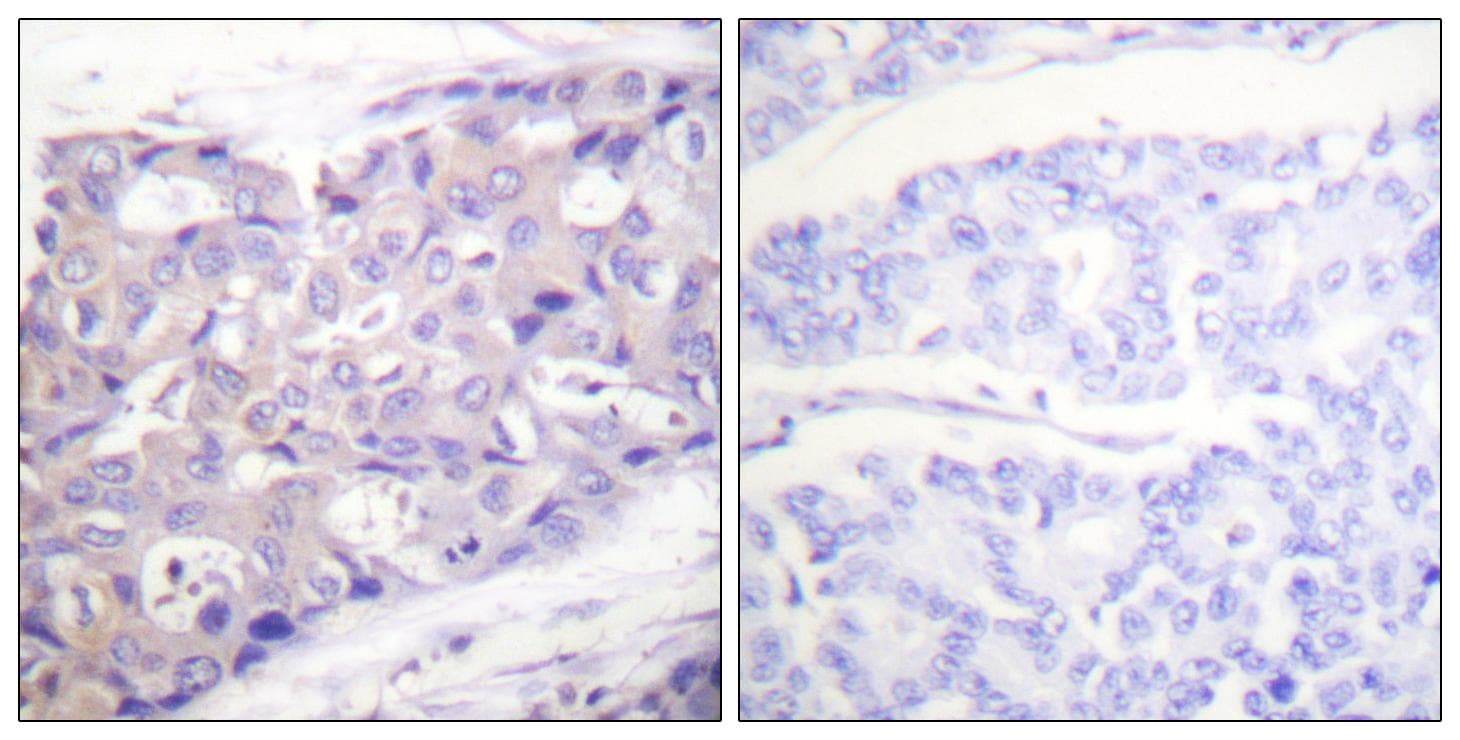 Polyclonal Rabbit anti-Human AKT1 Antibody (p326, IHC, IF, WB)
