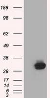 C21orf59 Antibody (clone OTI2H5)
