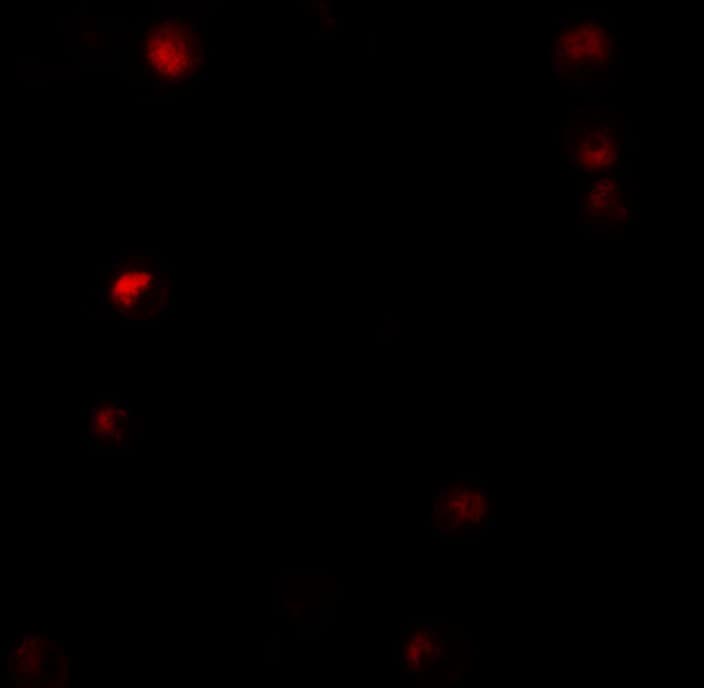 IHC-plus™ TMPO / TP / Thymopoietin Antibody