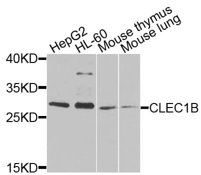 CLEC1B / CLEC-2 Antibody