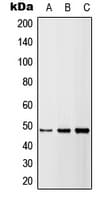 TNFRSF10B / Killer / DR5 Antibody (Internal)