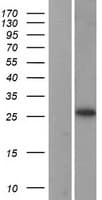 RPL13A Protein (Over-Expression Lysate Myc-DDK (Flag))