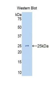KRT10 / CK10 / Cytokeratin 10 Antibody (aa317-455)