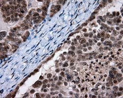 SRR / Serine Racemase Antibody (clone OTI7E8, Carrier-free)