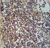 FAM49A Antibody (aa5-33)