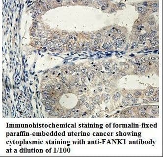 FANK1 Antibody (aa194-345)