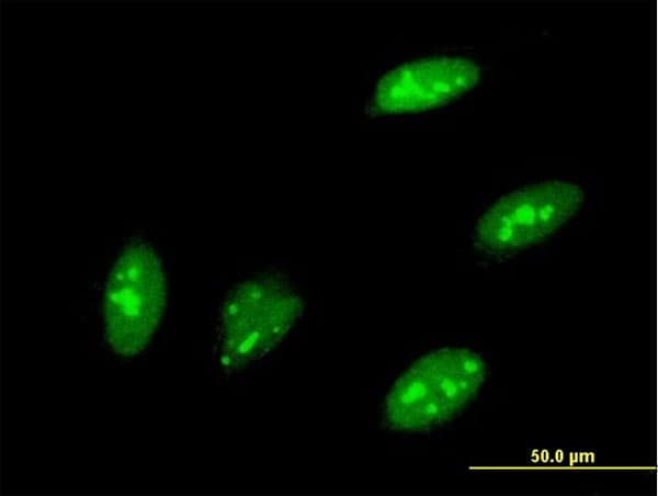 TEAD3 Antibody (clone 1C4)