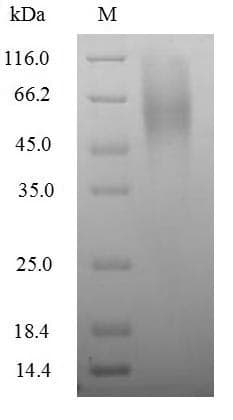 Outer capsid glycoprotein VP7 (Rotavirus A) (Recombinant 6His, N-terminus)