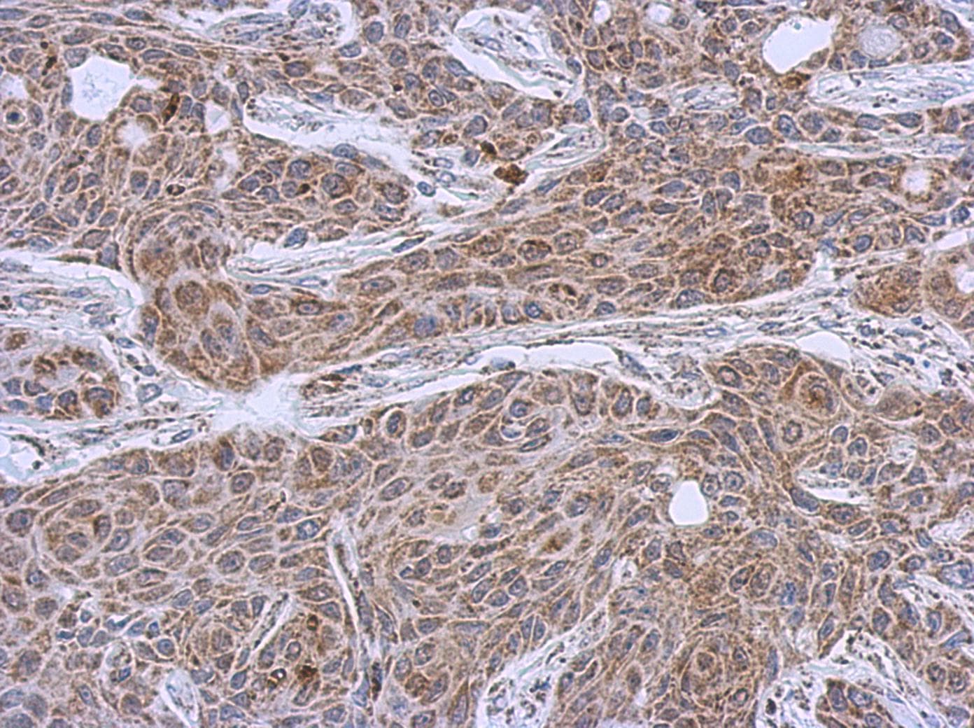 Polyclonal Rabbit anti-Human DLST / E2 Antibody (aa188-453, IHC, WB)