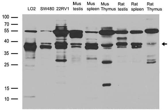 RFC2 / RFC40 Antibody