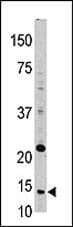 TXN / Thioredoxin / TRX Antibody (aa1-30)