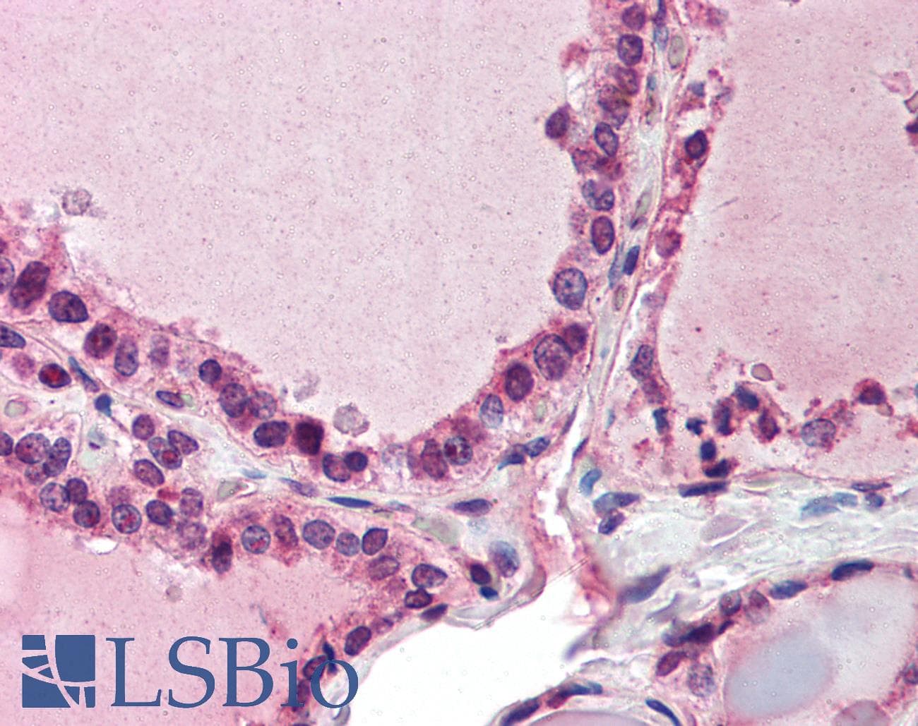 IHC-plus™ PAPD7 / TRF4-1 Antibody (aa447-462)