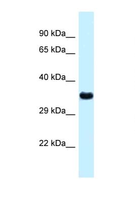 CTSZ / Cathepsin Z Antibody (aa21-70, Biotin)