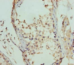 FBXO7 Antibody