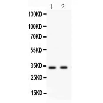 BIRC7 / Livin Antibody (aa87-298)