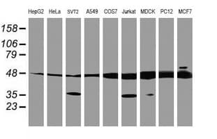 TUBAL3 Antibody (clone OTI4C5)
