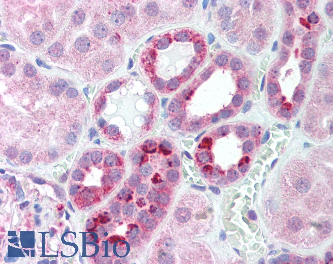 SERTAD1 / TRIP-Br1 / SEI-1 Antibody (N-Terminus)