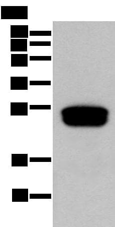 GLIPR1L1 Antibody