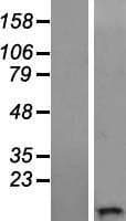 WFDC11 Protein (Over-Expression Lysate Myc-DDK (Flag))