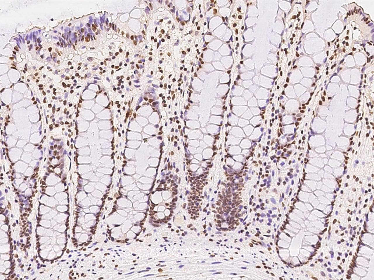Polyclonal Rabbit anti-Human ATXN7L1 Antibody (IHC)