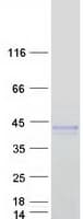Human ART5 Protein (Recombinant Myc-DDK (Flag))