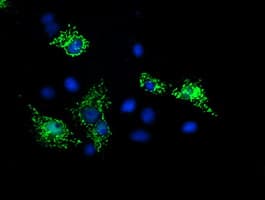 SIRT5 / Sirtuin 5 Antibody (clone OTI1B6)