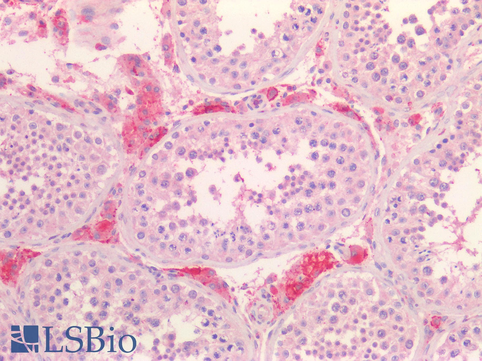 IHC-plus™ Polyclonal Goat anti-Human SCARB1 / SR-BI Antibody (aa238-250, IHC, WB)