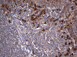 Monoclonal Mouse anti-Human PIK3C2A Antibody (clone OTI2D9, aa230-560, IHC, WB)