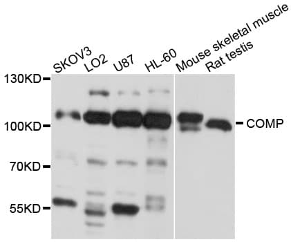 IHC-plus™ Polyclonal Rabbit anti-Human COMP / THBS5 Antibody (IHC, IF, WB)
