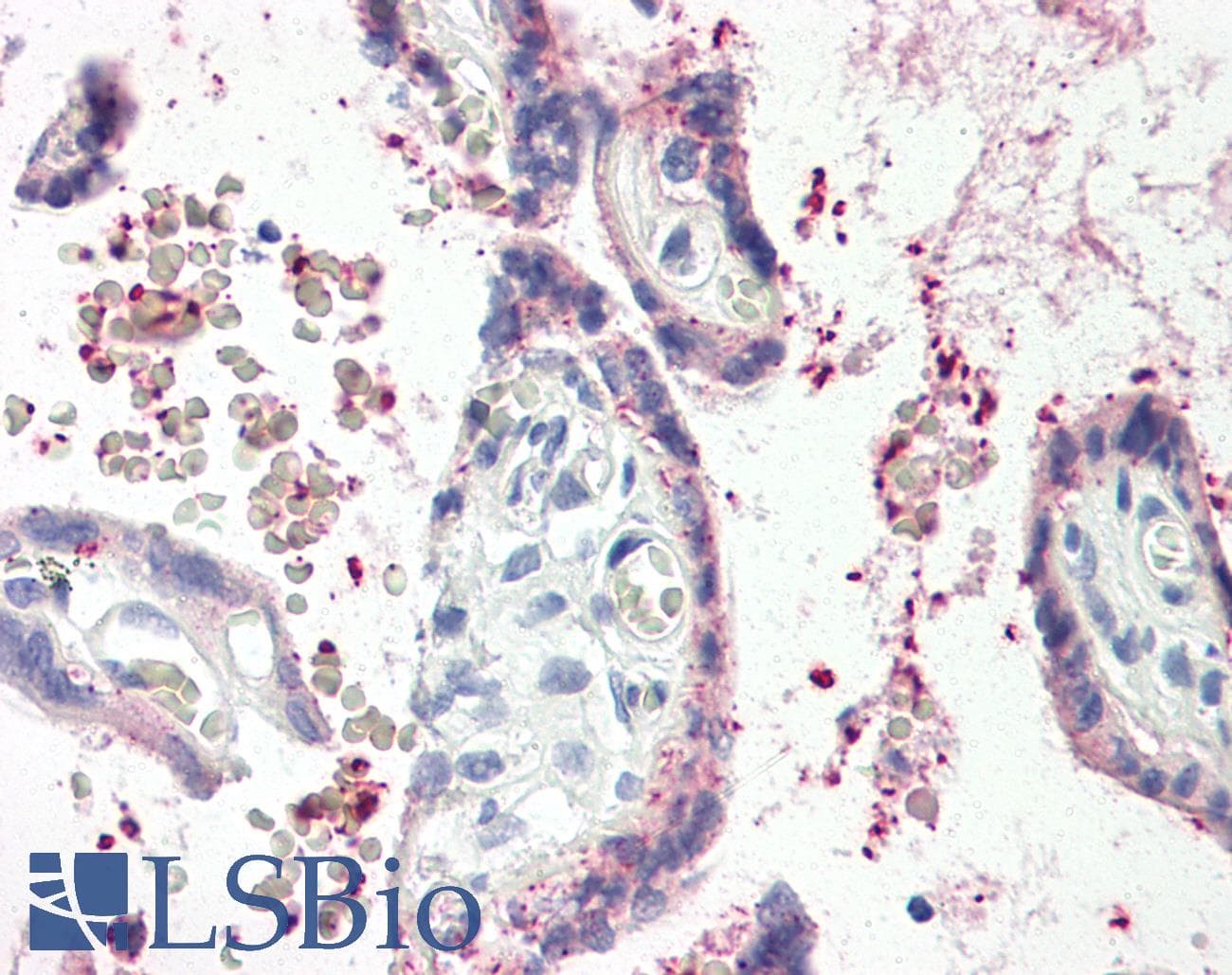 IHC-plus™ TIMP2 Antibody (aa178-193)